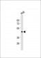 CASP4 Antibody (Center)